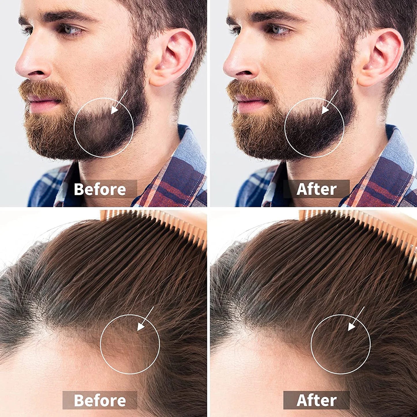 3 Packs Derma Roller 540 Microneedle Roller for Face Body Beard Hair Growth, Titanium Micro Needles Roller for Home Use