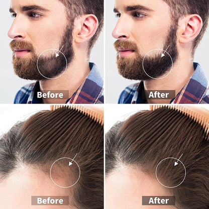 3 Packs Derma Roller 540 Microneedle Roller for Face Body Beard Hair Growth, Titanium Micro Needles Roller for Home Use